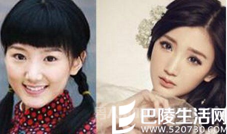 毛晓彤整容前后