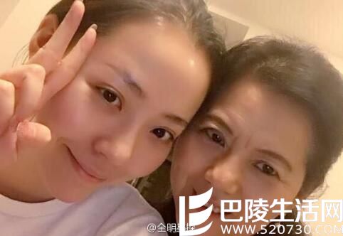 张靓颖与母亲张桂英 张靓颖与母亲张桂英