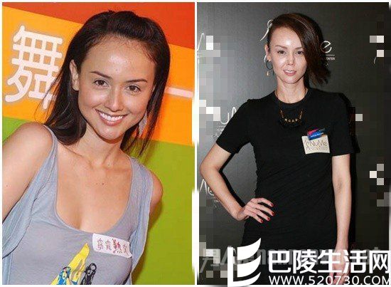 整容前后对比照