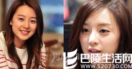 金智媛整容前后眼睛变化