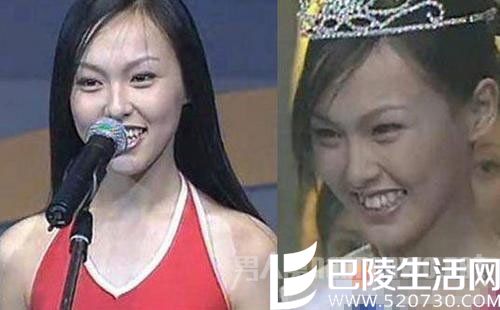 唐嫣18岁龅牙照