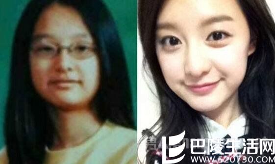金智媛整容前后，整容前大饼脸，整容后瓜子脸