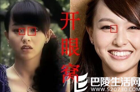 疑似唐嫣整容照曝光