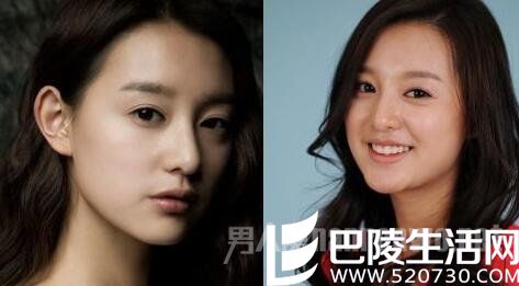 金智媛整容前后对比照，左边是整容后，右边是整容前