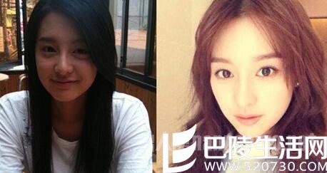 金智媛整容前后眼袋皮肤变化