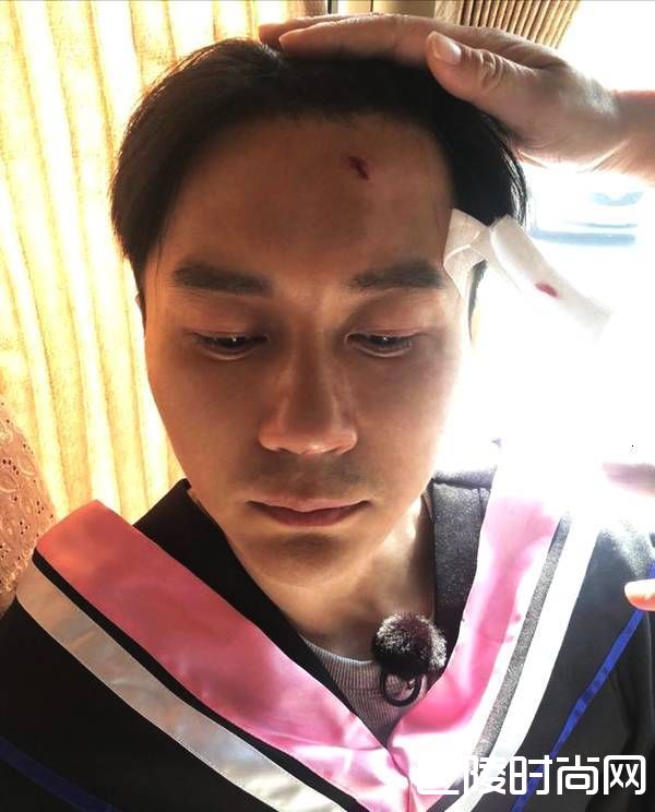 李晨学士帽砸伤照片