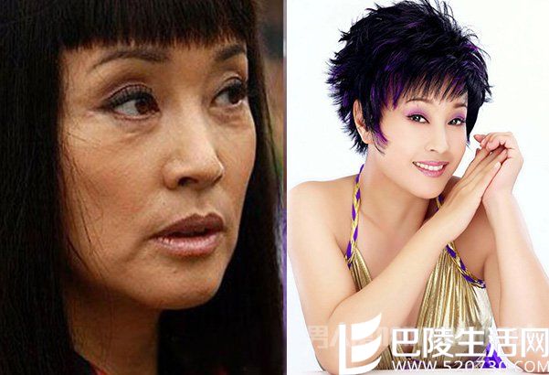 刘晓庆整容前后照片对比 刘晓庆整容前后照片对比