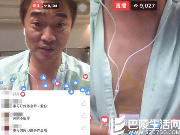 吴宗宪开直播晒伤口