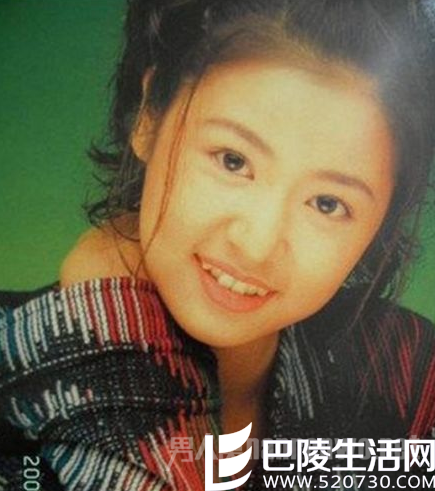 林心如整牙前 林心如整牙前