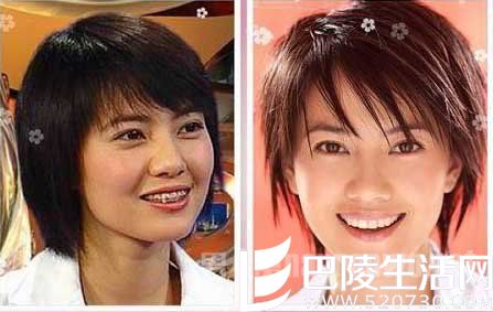 高圆圆整牙前后 高圆圆整牙前后