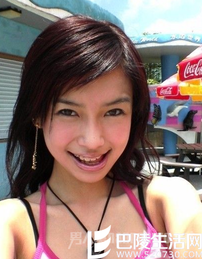 anglebaby整牙前 anglebaby整牙前