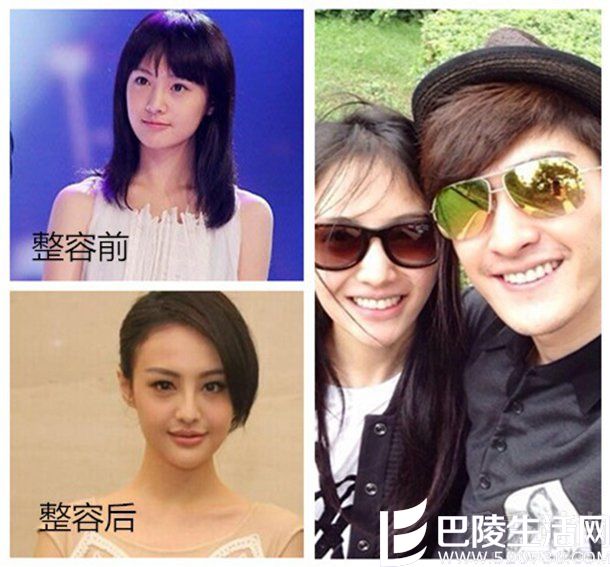 郑爽整容后变化很大
