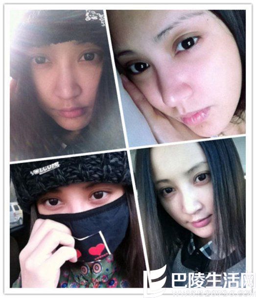 张歆艺疑似整容照 张歆艺疑似整容照