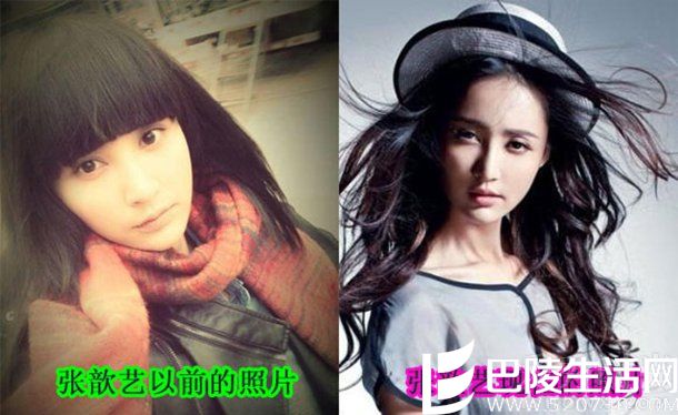 张歆艺整容前后的对比照