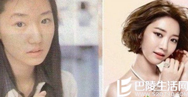 疑似高俊熙整容前后对比照