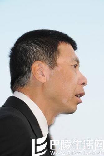 冯小刚白斑 冯小刚白斑