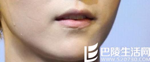 鹿晗嘴巴的疤 鹿晗嘴巴的疤