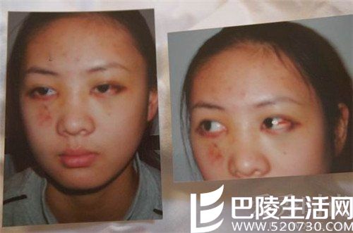 童谣被张默殴打