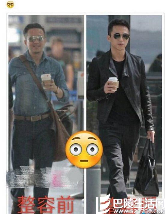 邓超整容前后 邓超整容前后