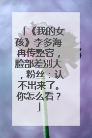 《我的女孩》李多海再传整容,脸部差别大,粉丝:认不出来了。你怎么看?