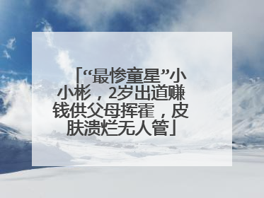 “最惨童星”小小彬,2岁出道赚钱供父母挥霍,皮肤溃烂无人管