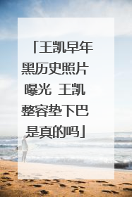 王凯早年黑历史照片曝光 王凯整容垫下巴是真的吗