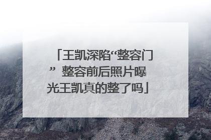 王凯深陷“整容门” 整容前后照片曝光王凯真的整了吗