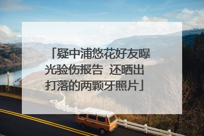 疑中浦悠花好友曝光验伤报告 还晒出打落的两颗牙照片