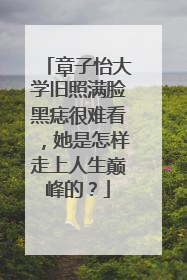章子怡大学旧照满脸黑痣很难看,她是怎样走上人生巅峰的?