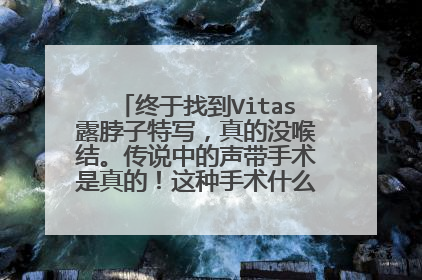 终于找到Vitas露脖子特写，真的没喉结。传说中的声带手术是真的！这种手术什么年龄可以做？危险吗
