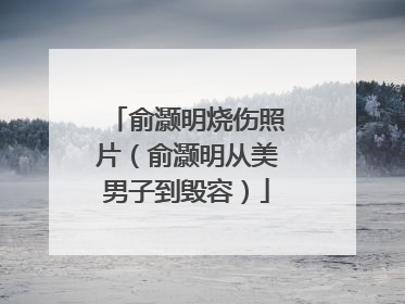 俞灏明烧伤照片(俞灏明从美男子到毁容)