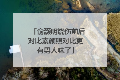 俞灏明烧伤前后对比素颜照对比更有男人味了