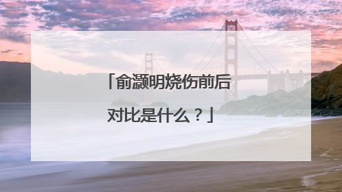 俞灏明烧伤前后对比是什么？