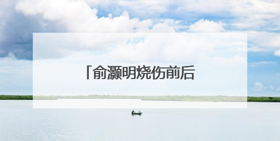 俞灏明烧伤前后对比是怎样的?