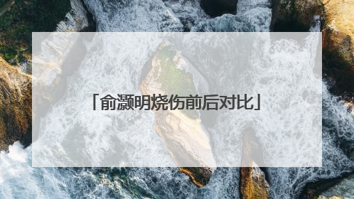 俞灏明烧伤前后对比
