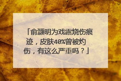 俞灏明为戏露烧伤痕迹，皮肤40%曾被灼伤，有这么严重吗？