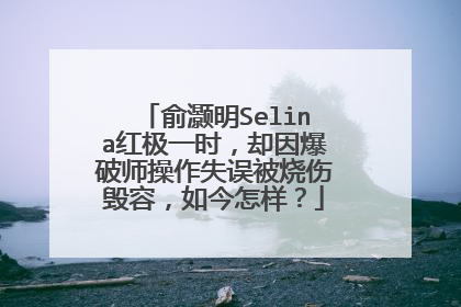 俞灏明Selina红极一时,却因爆破师操作失误被烧伤毁容,如今怎样?