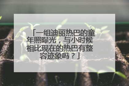 一组迪丽热巴的童年照曝光，与小时候相比现在的热巴有整容迹象吗？