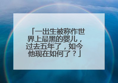 一出生被称作世界上最黑的婴儿，过去五年了，如今他现在如何了？