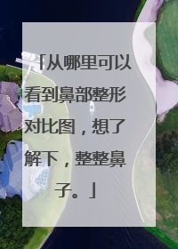 从哪里可以看到鼻部整形对比图，想了解下，整整鼻子。