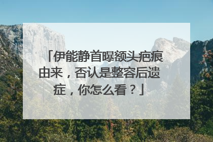 伊能静首曝额头疤痕由来，否认是整容后遗症，你怎么看？