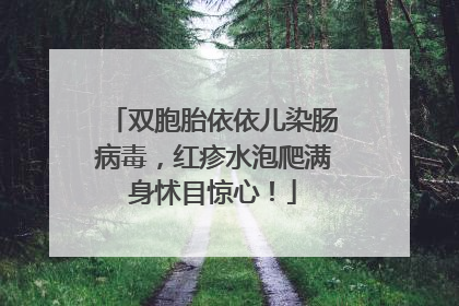 双胞胎依依儿染肠病毒，红疹水泡爬满身怵目惊心！