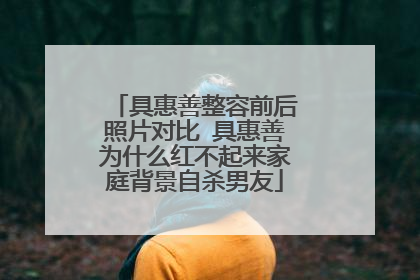 具惠善整容前后照片对比 具惠善为什么红不起来家庭背景自杀男友