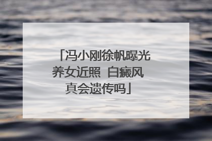 冯小刚徐帆曝光养女近照 白癜风真会遗传吗