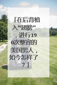 在后背植入“翅膀”,进行190次整容的美国男人,如今怎样了?