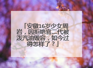 安徽16岁少女周岩,因拒绝官二代被泼汽油毁容,如今过得怎样了?