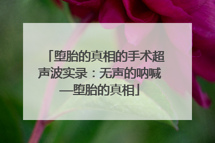 堕胎的真相的手术超声波实录：无声的呐喊——堕胎的真相