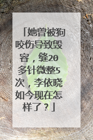 她曾被狗咬伤导致毁容，缝20多针微整5次，李依晓如今现在怎样了？