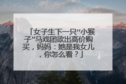 女子生下一只“小猴子”马戏团欲出高价购买,妈妈:她是我女儿,你怎么看?