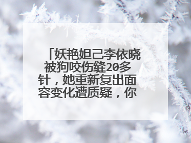妖艳妲己李依晓被狗咬伤缝20多针,她重新复出面容变化遭质疑,你怎么看?